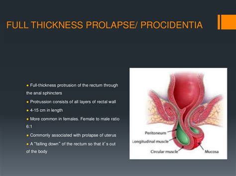 fisting prolapse|'extreme prolapse fisting' Search .